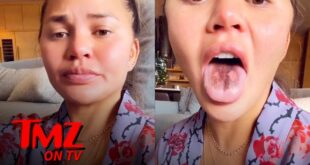 Chrissy Teigen's Tongue Is Peeling After Eating Too Much Sour Candy | TMZ TV