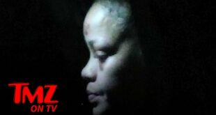 Rihanna's Bruised Face Caused By Nasty e-Scooter Accident | TMZ TV