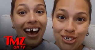 Ashley Graham Broke Her Front Tooth After Biting A Frozen Cookie | TMZ